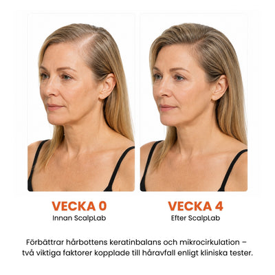 ScalpLab Density Serum - Synligt tätare hår redan efter 4 veckor
