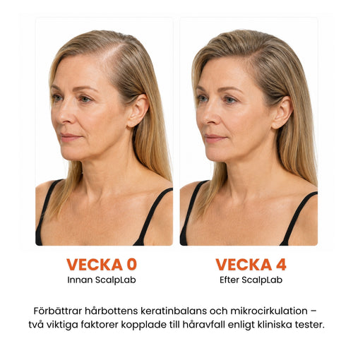 ScalpLab Density Serum - Synligt tätare hår redan efter 4 veckor
