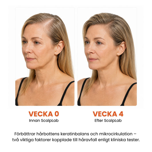 ScalpLab Density Serum - Synligt tätare hår redan efter 4 veckor