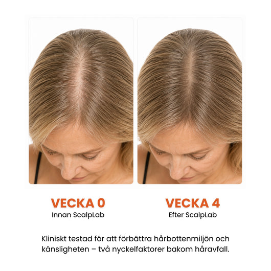 ScalpLab Density Serum - Synligt tätare hår redan efter 4 veckor